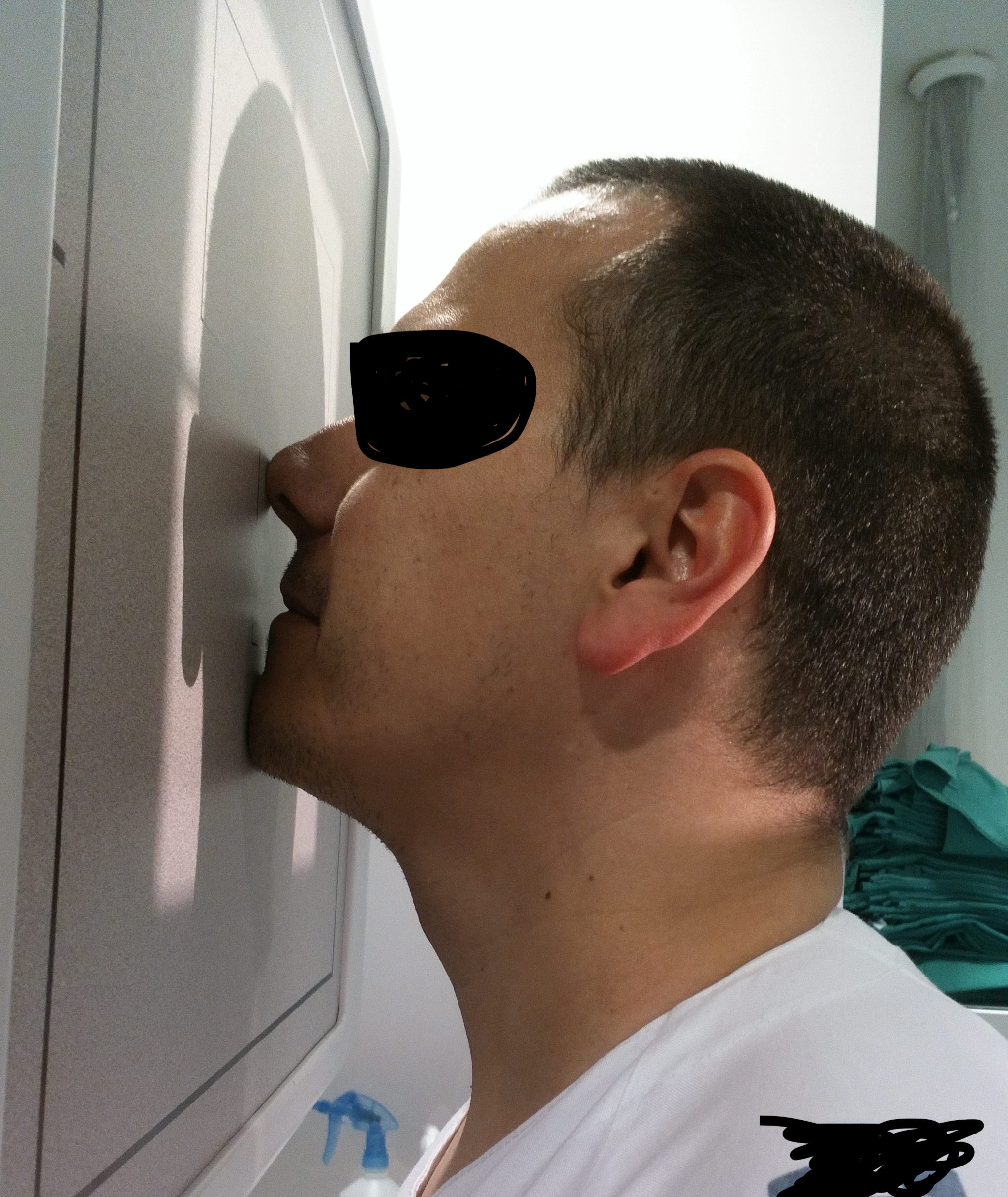 Anatomía senos paranasales